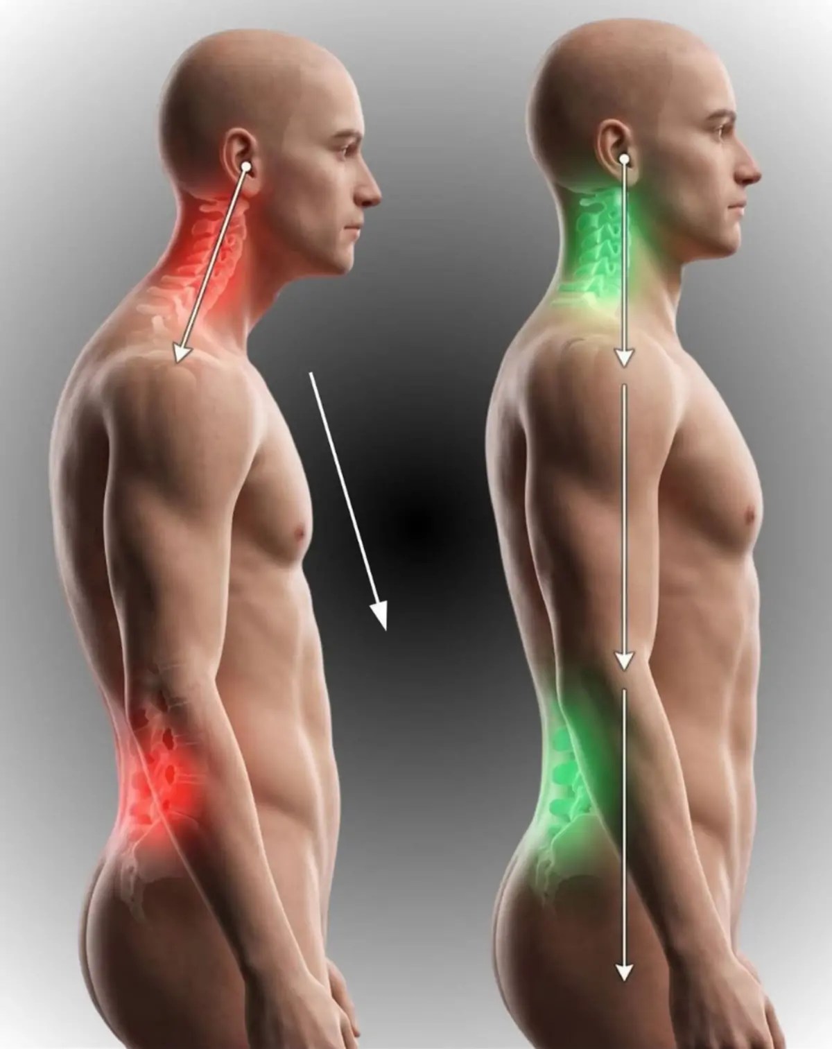 Cervicales et épaules en tension